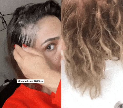 Activador Capilar con Células Madre y Factores de Crecimiento